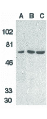Western Blot of DcR1 Antibody