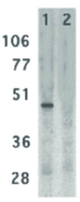 Western Blot of DC-SIGN Antibody