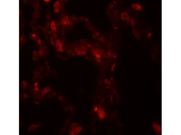 Immunofluorescence of DDC