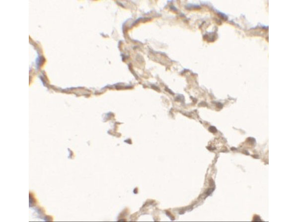Immunohistochemistry of DDC