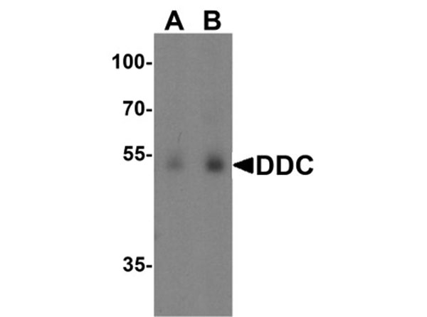 Western blot of DDC