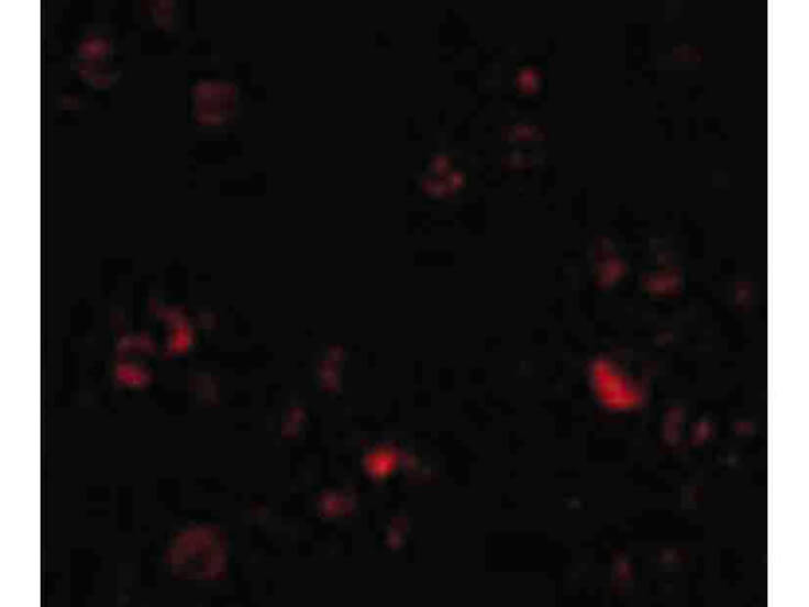 Immunofluorescence of DDX3 Antibody