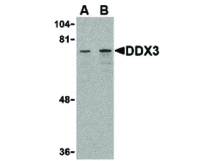 Western Blot of DDX3 Antibody