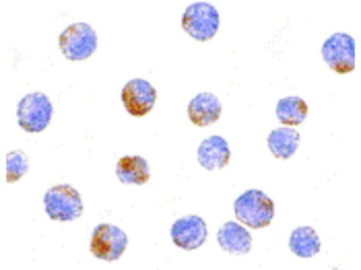 Immunocytochemistry of DDX3 Antibody