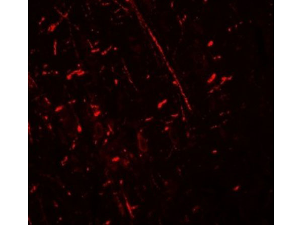 Immunofluorescence of DDX41
