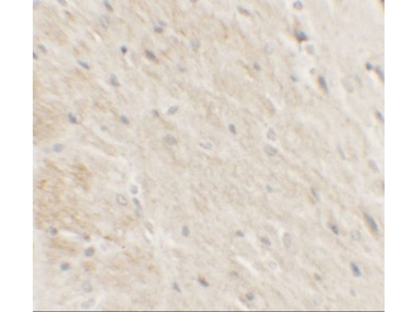 Immunohistochemistry of DDX41