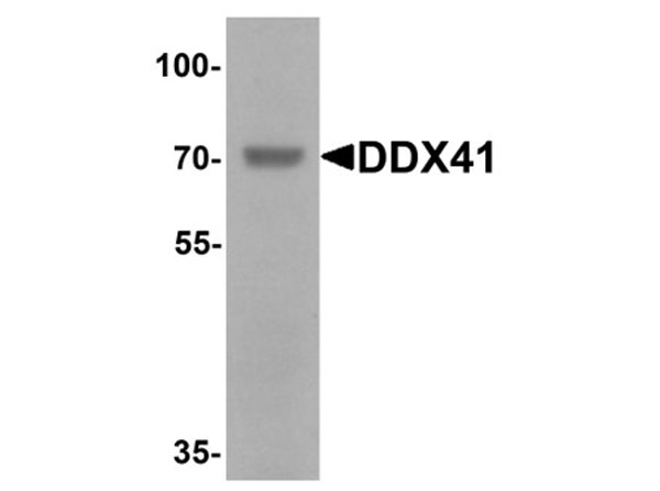 Western blot of DDX41