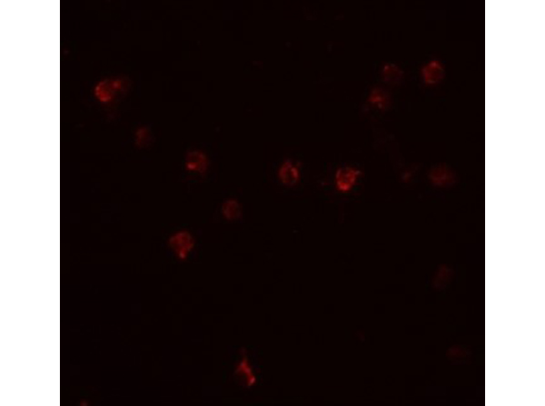 Immunofluorescence of DDX60