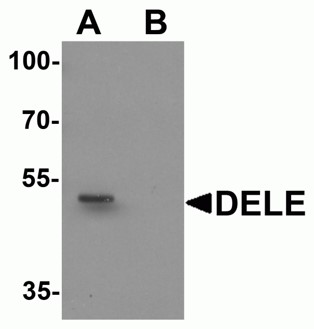 Immunofluorescence of DELE