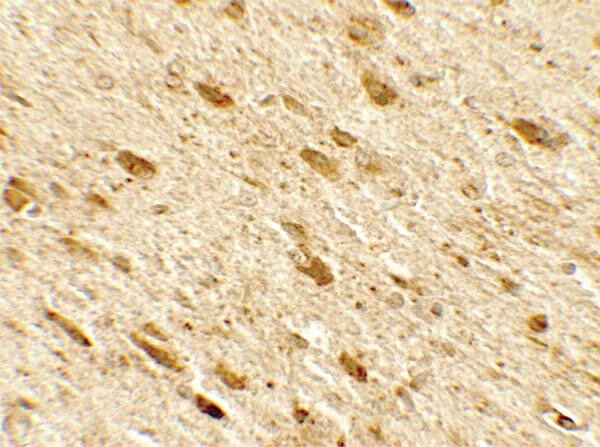 Immunohistochemistry of DENR Antibody