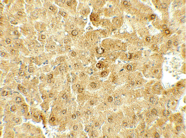 Immunohistochemistry of DEPTOR Antibody