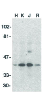 Western Blot of DFF40 Antibody