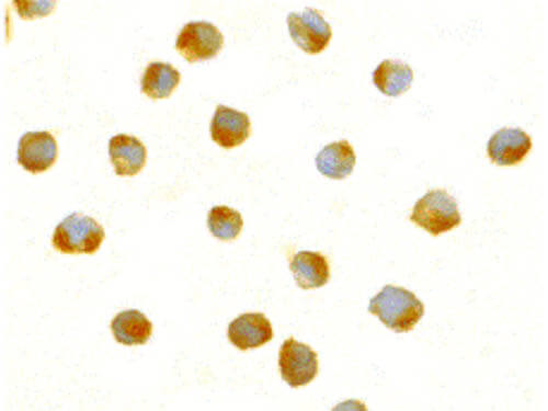 Immunocytochemistry of DFF40 Antibody