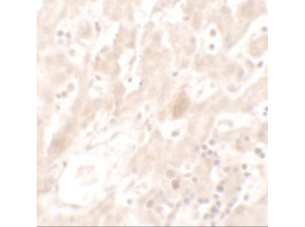 Immunohistochemistry of DHX36