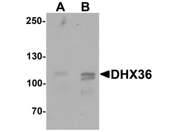 Western blot analysis of DHX36