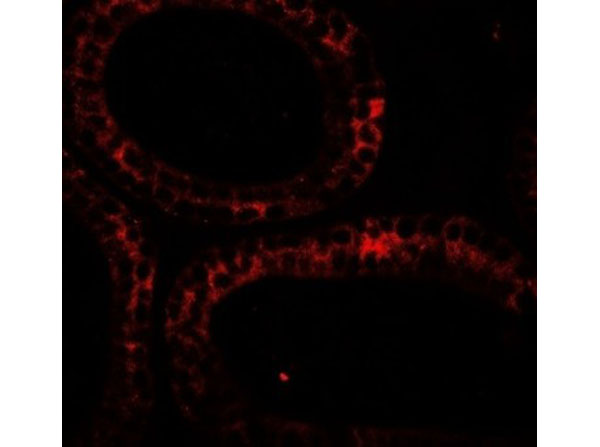 Immunofluorescence of DIS3