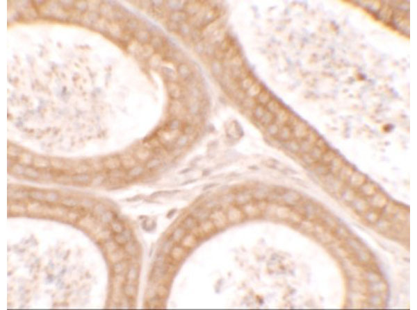 Immunohistochemistry of DIS3