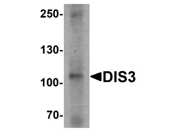 Western blot of DIS3