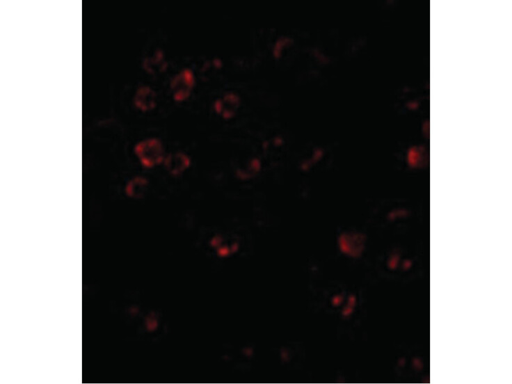 Immunofluorescence of DISC1 Antibody