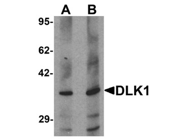 Western blot analysis of DLK1