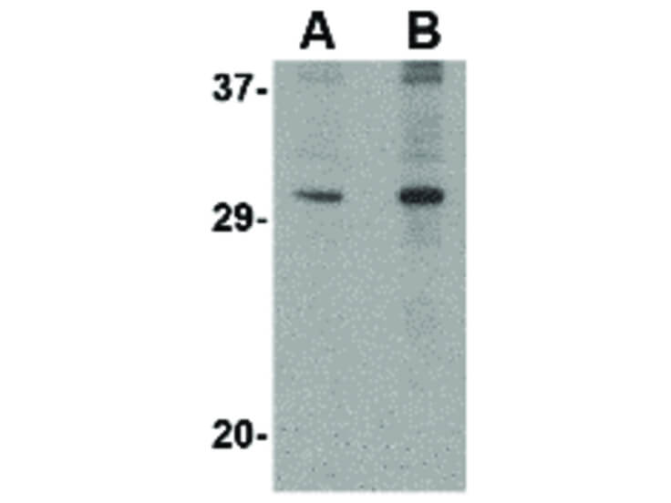 Western Blot of DNAL1 Antibody