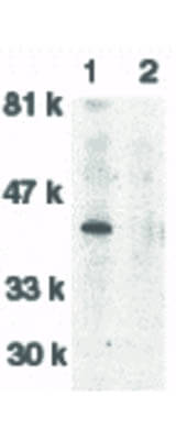 Western Blot of DNase II Antibody