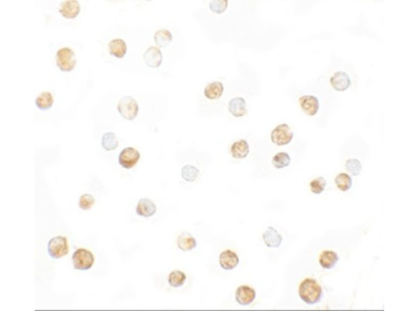 Immunocytochemistry of DNM1L