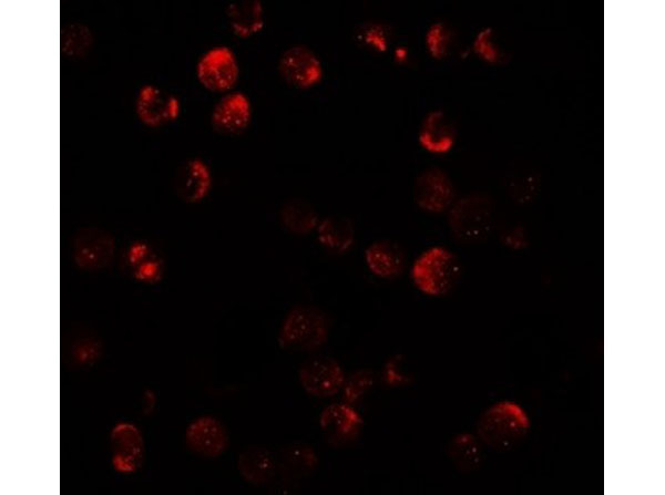 Immunofluorescence of DNM1L