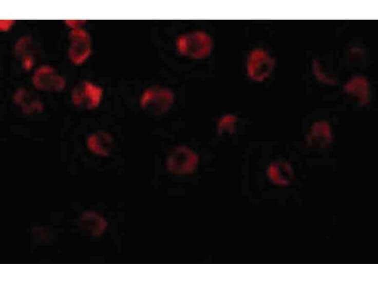 Immunofluorescence of DOK1 Antibody