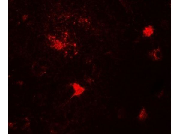 Immunofluorescence of DPF3