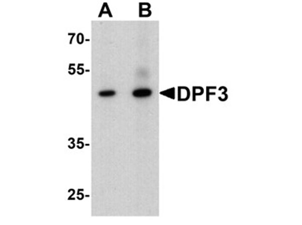 Western blot of DPF3