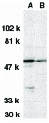 Western Blot of DRAK1 Antibody