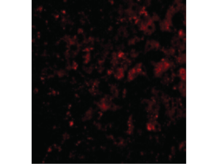 Immunofluorescence of DRAM Antibody