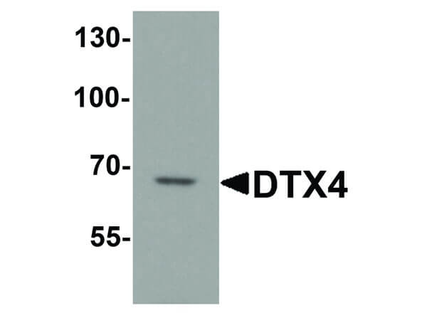 Western Blot of DTX4 Antibody