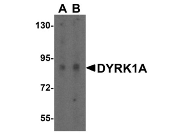 Western blot analysis of DYRK1A