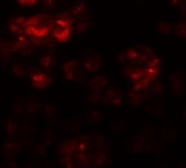 Immunofluorescence of DYRK2