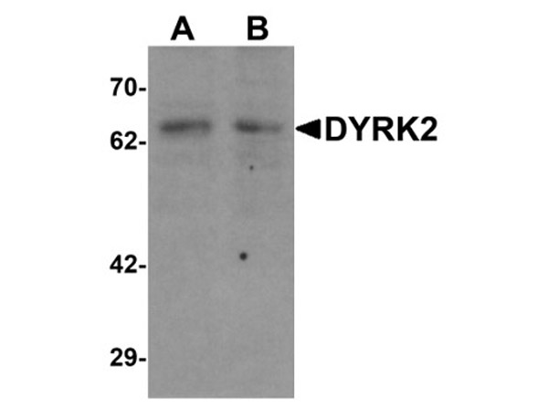 Western blot analysis of DYRK2