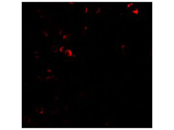 Immunofluorescence of E2F3 Antibody