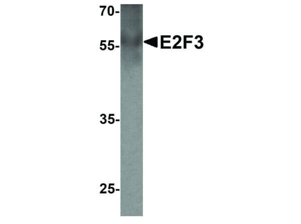 Western Blot of E2F3 Antibody