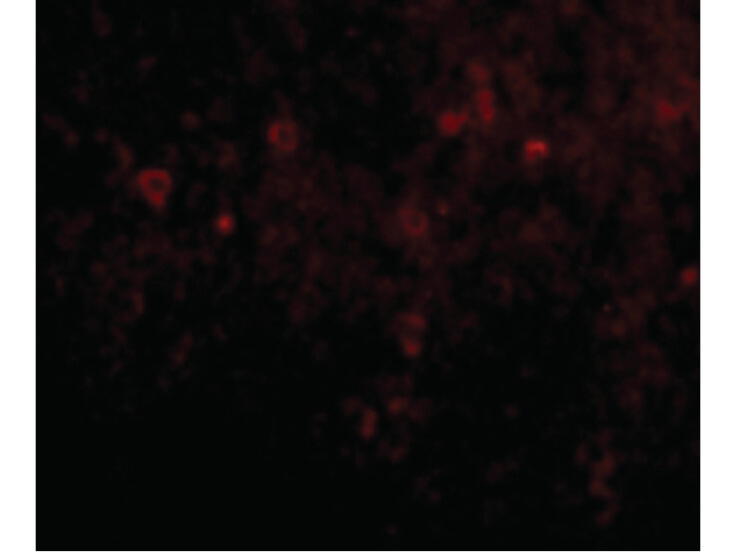 Immunofluorescence of EBI3 Antibody
