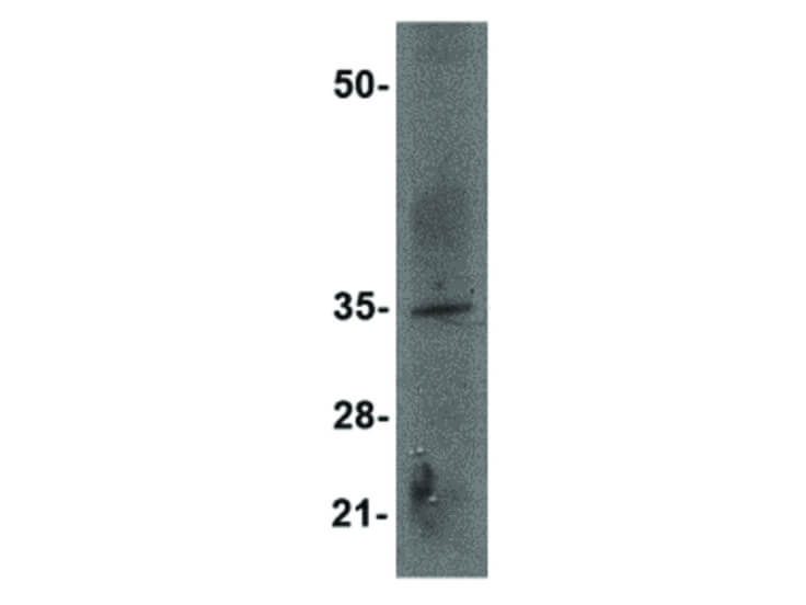Western Blot of EBI3 Antibody