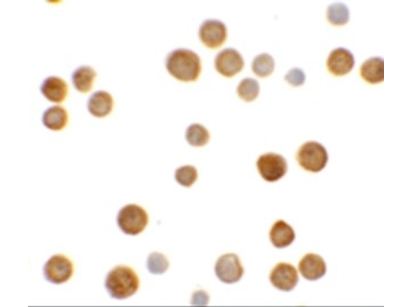 Immunocytochemistry of ECRG4