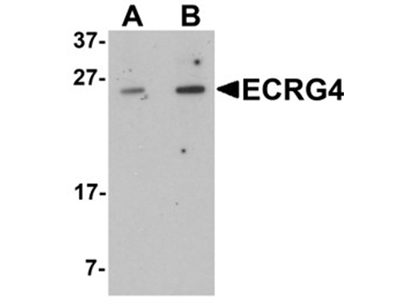 Western blot analysis of ECRG4