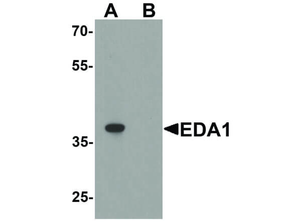 Western Blot of EDA1 Antibody