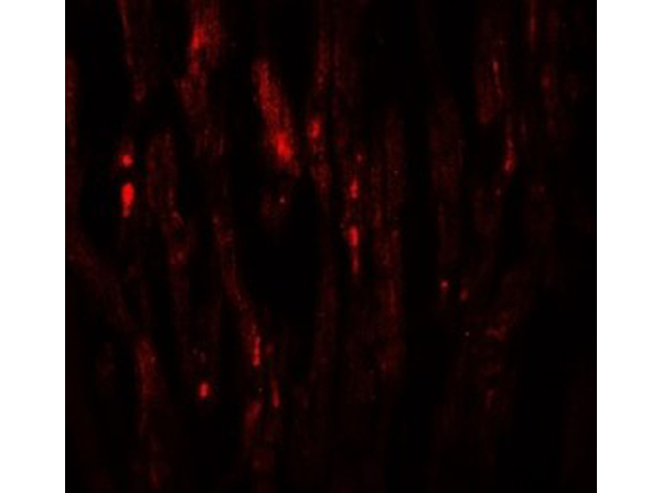 Immunofluorescence of EED