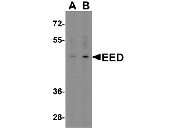 Western blot analysis of EED