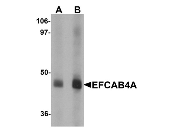 Western blot analysis of EFCAB4A