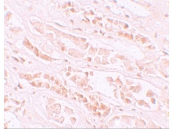 Immunohistochemistry of EFCAB4B