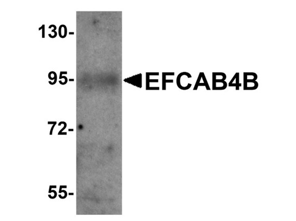 Western blot of EFCAB4B