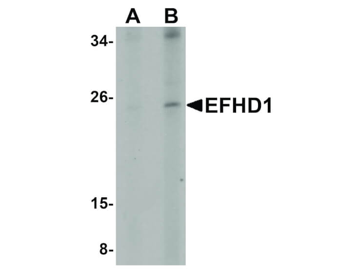 Western Blot of EFHD1 Antibody